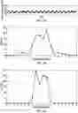 Fig. 04 - Method and apparatus for enhancing atrial fibrillation detection