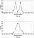 Fig. 05 - Method and apparatus for enhancing atrial fibrillation detection