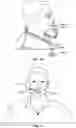 Fig. 19 - Wearable device for delivering air