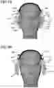Fig. 07 - Quick donning comfortable respiratory mask system for aircraft pilot