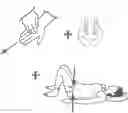 Fig. 01 - METHOD FOR REDUCING TENSION IN MUSCLES OF THE HUMAN BODY BY NEUROHEMATOLOGIC DIVERSION