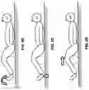 Fig. 06 - METHOD FOR REDUCING TENSION IN MUSCLES OF THE HUMAN BODY BY NEUROHEMATOLOGIC DIVERSION