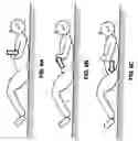 Fig. 13 - METHOD FOR REDUCING TENSION IN MUSCLES OF THE HUMAN BODY BY NEUROHEMATOLOGIC DIVERSION