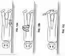 Fig. 20 - METHOD FOR REDUCING TENSION IN MUSCLES OF THE HUMAN BODY BY NEUROHEMATOLOGIC DIVERSION