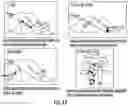Fig. 27 - METHOD FOR REDUCING TENSION IN MUSCLES OF THE HUMAN BODY BY NEUROHEMATOLOGIC DIVERSION