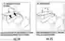 Fig. 34 - METHOD FOR REDUCING TENSION IN MUSCLES OF THE HUMAN BODY BY NEUROHEMATOLOGIC DIVERSION