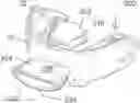 Fig. 01 - Oral training appliance