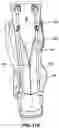 Fig. 115 - Snap fit golf bag assembly