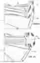 Fig. 33 - Snap fit golf bag assembly