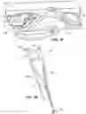 Fig. 37 - Snap fit golf bag assembly