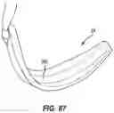 Fig. 52 - Snap fit golf bag assembly