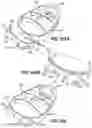 Fig. 60 - Snap fit golf bag assembly