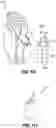 Fig. 66 - Snap fit golf bag assembly