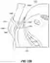 Fig. 83 - Snap fit golf bag assembly