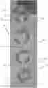 Fig. 01 - Apparatus and method for facilitating fine motor skill improvement