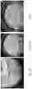 Fig. 02 - METHOD FOR PRODUCING METAL-CONTAINING CATALYSTS