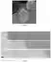 Fig. 04 - Method for producing a microfluidic device