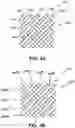 Fig. 04 - Braided medical devices