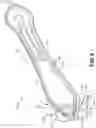 Fig. 03 - Winged cutter