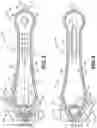 Fig. 04 - Winged cutter