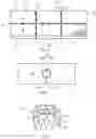Fig. 04 - Device and a method of aligning core elements using such device