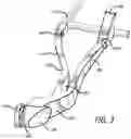 Fig. 04 - Universal wishbone trailing arm