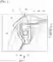 Fig. 04 - Vehicle pillar structure