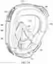 Fig. 16 - Snorkel and diving mask system