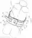 Fig. 08 - Cushion sleeve