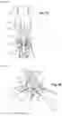 Fig. 06 - Loading of solid particles into a vessel