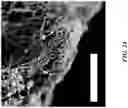 Fig. 28 - Oxidative coupling of methane implementations for olefin production