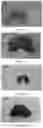 Fig. 14 - RETINOID COMPOUND, PREPARATION METHOD THEREFOR, INTERMEDIATES THEREOF AND APPLICATION THEREOF