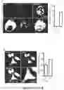 Fig. 02 - Method of treatment