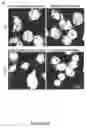 Fig. 14 - Method of treatment