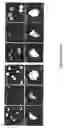 Fig. 32 - Method of treatment