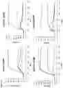Fig. 09 - Anti-ApoC3 antibodies
