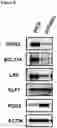Fig. 11 - Compositions and methods for treating beta-globinopathies