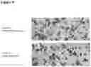 Fig. 12 - Compositions and methods for treating beta-globinopathies