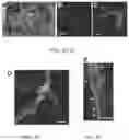 Fig. 05 - Compositions and methods to improve anti-angiogenic therapy and immunotherapy