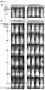 Fig. 14 - Chimeric antigen receptors and CAR-T cells that bind CXCR5 and methods of use thereof to treat medical disorders