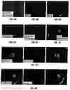 Fig. 07 - Anti-MCAM Antibodies And Associated Methods Of Use
