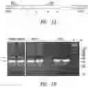 Fig. 02 - Compositions and methods comprising histidyl-tRNA synthetase splice variants having non-canonical biological activities