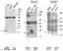 Fig. 07 - Compositions and methods comprising histidyl-tRNA synthetase splice variants having non-canonical biological activities