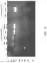 Fig. 26 - Compositions and methods comprising histidyl-tRNA synthetase splice variants having non-canonical biological activities