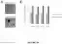 Fig. 12 - BINDING PROTEINS 2