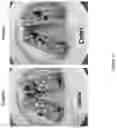 Fig. 12 - Compositions comprising glucose and hemicellulose and their use