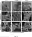 Fig. 12 - Carbon nanotube-functionalized reverse thermal gel and methods of forming and using same