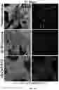 Fig. 18 - Carbon nanotube-functionalized reverse thermal gel and methods of forming and using same