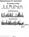 Fig. 20 - Carbon nanotube-functionalized reverse thermal gel and methods of forming and using same
