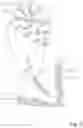 Fig. 03 - Composite material and use thereof